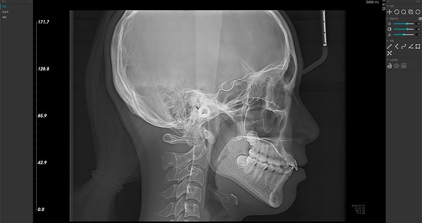 Интерфейс программного обеспечения Meyer 3D диагностика