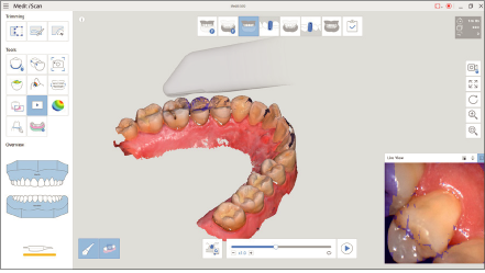 Функция Scan Replay в Medit i500