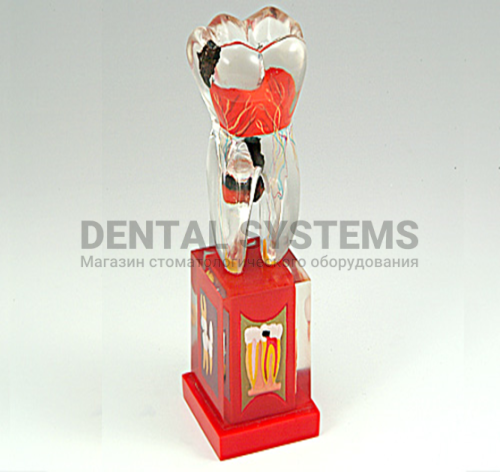 TOOTH MODEL M-TAPE HL-60005, Hanil
