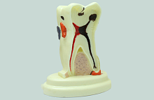 TOOTH MODEL S-TYPE HL-60030, Hanil