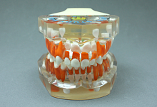 TOOTH MODEL F-TAPE HL-60008, Hanil