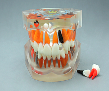 TOOTH MODEL P-TAPE HL-60007, Hanil