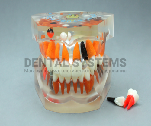TOOTH MODEL P-TAPE HL-60007, Hanil TOOTH MODEL P-TAPE HL-60007, Hanil