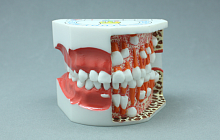 TOOTH MODEL D-TAPE HL-60004, Hanil