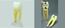 TOOTH MODEL R-TAPE (HL-60028), Hanil