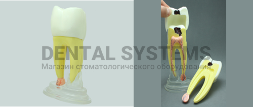 TOOTH MODEL R-TAPE (HL-60028), Hanil TOOTH MODEL R-TAPE (HL-60028), Hanil