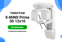 Акция на томограф X-MIND Prime 3D 12x10