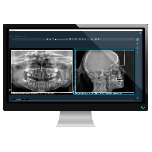 Томограф X-MIND Prime 3D 12x10 - самый компактный полноценный кт для небольших рентген кабинетов фото 6