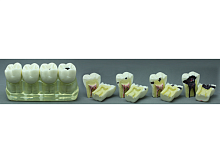TOOTH MODEL W-TYPE HL-60034, Hanil