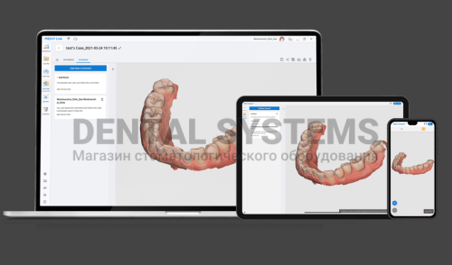Интраоральный 3D-сканер Medit i700 фото 3 Интраоральный 3D-сканер Medit i700 фото 3
