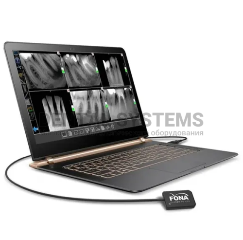 Радиовизиограф Fona StarX PRO фото 6