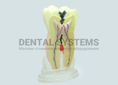 TOOTH MODEL H-TAPE HL-60009, Hanil